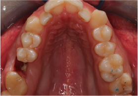 mse5